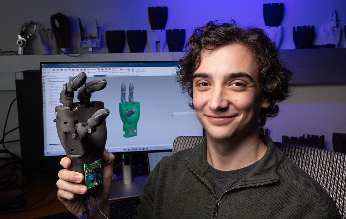 Steven Reimer holding prosthetic hand sitting in front of computer screen